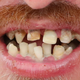 Illustration for article titled German Soccer Player Bites Off (And Maybe Eats?) Chunk Of Opponent's Nose